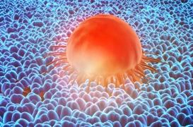 Cancer : un gène qui favorise les métastases et les résistances aux traitements identifié