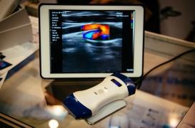 Échographies : bientôt des examens réalisés grâce à un smartphone ?
