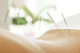 Polyarthrite rhumatoïde : l’acupuncture réduirait le risque accru d’AVC