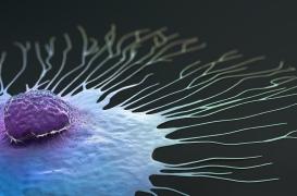 Faut-il changer la façon de nommer les cancers métastatiques ?