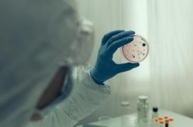 Des chercheurs découvrent comment les virus Ebola et Marburg perturbent le système digestif