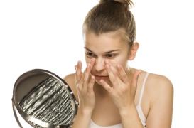 Cernes sous les yeux : les autres causes que la fatigue