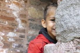 Malformation faciale infantile rare : une découverte révolutionnaire dans le traitement !