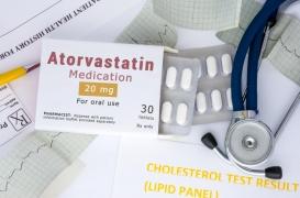 Les statines ne provoquent pas de douleurs musculaires