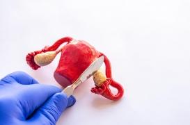 L’ovariectomie est associée à un vieillissement prématuré et à des maladies chroniques