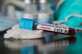 Le gouvernement veut multiplier les tests pour dépister le Covid-19