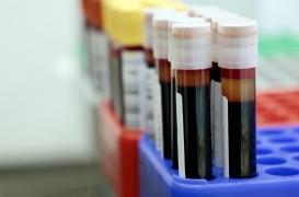 Un vaccin expérimental contre le Covid-19 présente des résultats encourageants