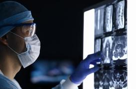 Détection des cancers : le scanner qui change tout dans les hôpitaux