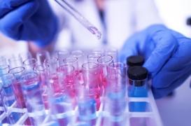 Coronavirus : pourquoi les tests sont-il négatifs chez certaines personnes infectées ?