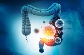 Cancer du rectum avancé : de nouveaux espoirs de traitement pour les malades