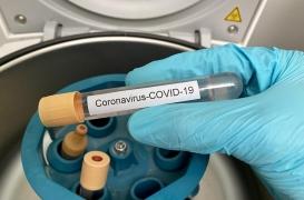 Covid-19 : un test salivaire à faire chez soi en 24 heures