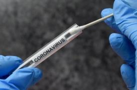 Covid-19 : le match des tests