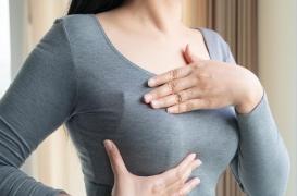 Cancer du sein triple négatif : 