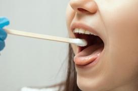 Un test salivaire pour détecter un cancer ORL