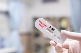 Covid-19 : du retard pour les autotests et un nouveau test sérologique simple et efficace