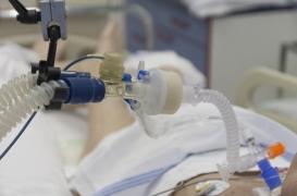 Covid-19 : pourquoi y a-t-il de plus en plus de jeunes en réanimation ?