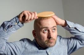 Devenir chauve : c’est bien une affaire de génétique