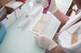 Maladie de Creutzfeldt-Jakob : un traitement prometteur à l’essai 