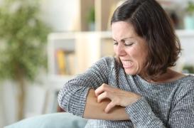 Eczéma, psoriasis, vitiligo... Les dermatoses visibles embarrassent fortement les malades