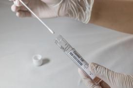 Covid-19 : le dépistage rectal, plus efficace que le nasal, confirme l’intérêt d’analyser les eaux usées
