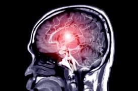 AVC : trop de télévision augmente les risques