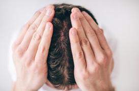 Pourquoi peut-on devenir chauve ?