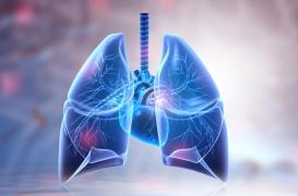 Cancer du poumon : chez les non-fumeurs, des signatures génétiques différentes