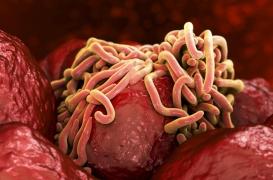 Vers intestinaux : un régime riche en graisses aide à s’en débarrasser 