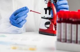 Variole du singe, Covid et VIH : un homme a contracté les maladies au même moment 