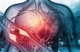 Foramen ovale, fibrillation atriale et AVC : quelle stratégie ?