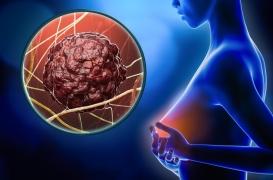 Alcool, hormones, pollution… des facteurs augmentant le risque de cancer du sein ?