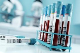 Pour la première fois, des microplastiques ont été identifiés dans du sang humain