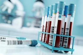 VIH : pourra-t-on bientôt éviter les traitements à vie ?