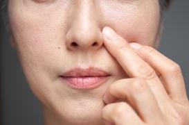 Quelles sont les solutions pour lutter contre les cernes ? 