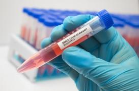 Covid-19 : le variant brésilien est plus transmissible et pourrait échapper à l’immunité acquise
