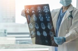 Les traumatismes à la tête doublent les risques de mort précoce