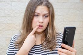 Herpès, une affection de l’été ! 