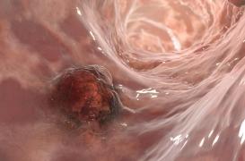 Pourquoi de plus en plus de personnes se font tatouer le côlon