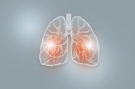 La journaliste Catherine Matausch soignée pour un cancer du poumon