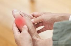 Crise de goutte : les boissons sucrées sont déconseillées