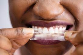 Blanchiment des dents : attention aux produits nocifs ou inutiles !