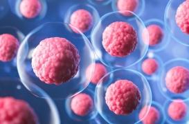 Maladie de Parkinson : un premier patient reçoit une greffe de cellules souches