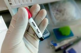 Grippe aviaire : des chercheurs alertent le gouvernement américain sur le manque de tests 