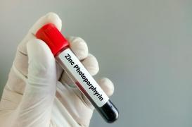 Et si le taux de zinc avait un lien avec la sclérose en plaques ?