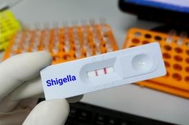 IST : pourquoi la shigellose inquiète les autorités sanitaires ?