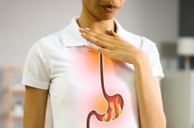 Cancer de l’estomac : un risque avec la prise d’IPP à long terme ? 