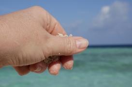 Ongles jaunes : quelles causes et quels traitements ?