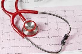 Fibrillation atriale : un dépistage chez le généraliste pourrait réduire les risques d'AVC