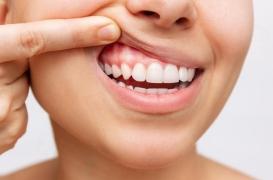 Comment le diabète fragilise l’émail des dents