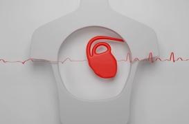 Fibrillation atriale : 